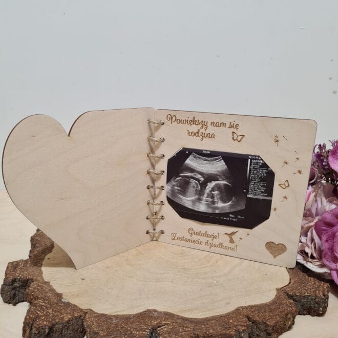 Wiadomość dla rodziców zostaniecie dziadkami "JEST TAKA NOWINA POWIĘKSZY NAM SIĘ RODZINA"
